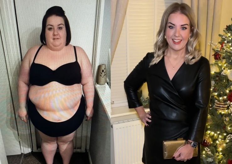 영국 37세 여성이 76kg 감량에 성공한 사연을 전했다. 사진=더선