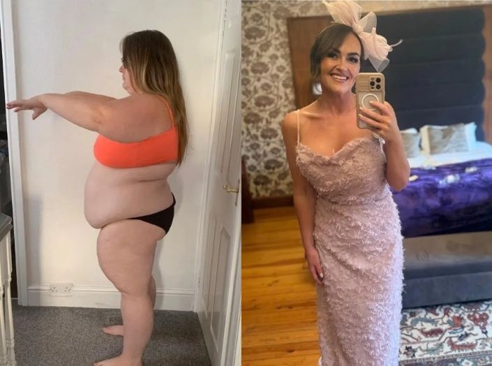 영국 30대 여성의 70kg 감량 전후 사진. 사진=더선