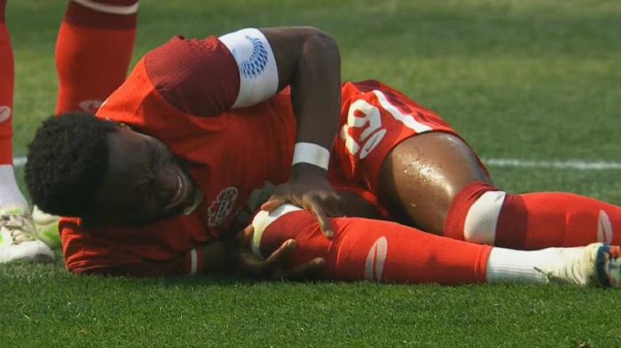 바이에른 뮌헨 주전 수비수 알폰소 데이비스가 A매치 기간 캐나다 대표팀에 합류해 경기를 치르다 무릎 십자인대 파열 부상을 입었다. 치료를 위해 수술을 받아 시즌 아웃 판정을 받았다. 사진=SNS