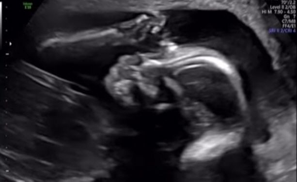 사진 출처=임정희 계정