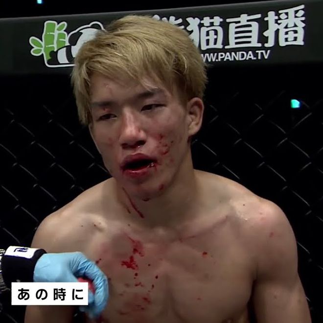 아사쿠라 가이가 2022년 4월 Rizin 유튜브 영상에 출연하여 2017년 6월 로드FC에서 종합격투기 프로 데뷔 이후 처음으로 당한 패배를 회상할 때 사용된 자료 화면. 사진=라이진FF