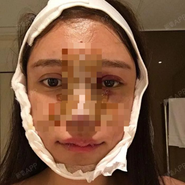 에비는 성형 수술 ‘여정’을 자신의 SNS에 공유하고 있다. [사진 = BBC]