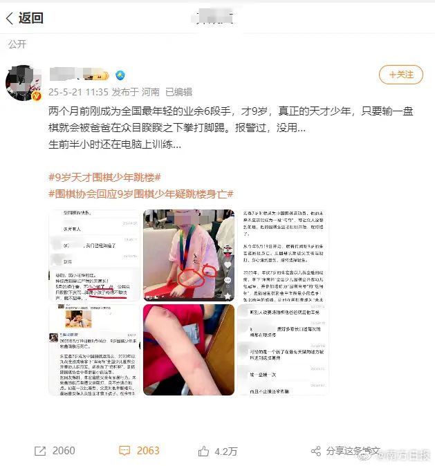 한 누리꾼이 중국 현지 SNS에 주모신 군이 친부에게 가정 폭력을 당했다는 글을 게시했다. [사진 = 위챗]