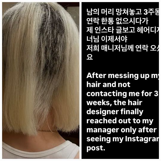 거울 속 모습이 낯설고, 머리를 감을 때마다 두려워졌다.사진=DJ 소다 SNS