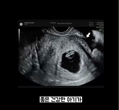 사진 =  박인영  SNS