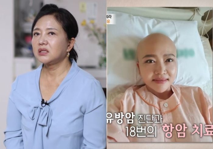 김희라. 사진|MBN ‘특종세상’