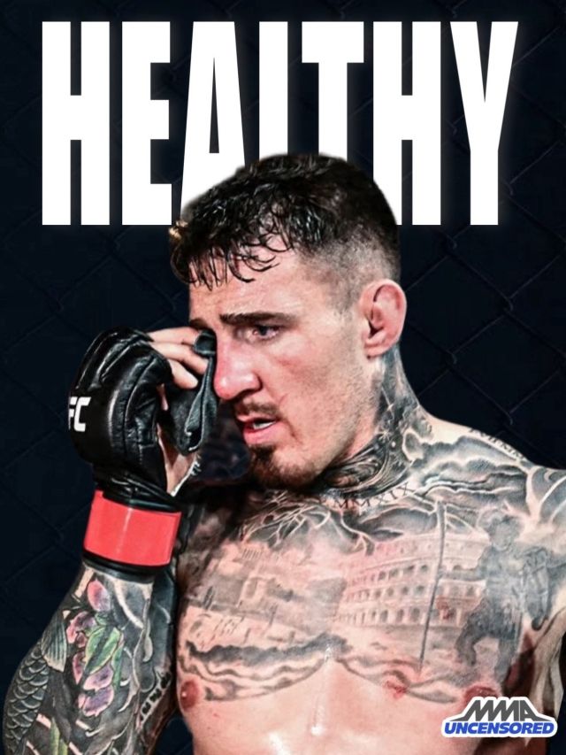 불행 중 다행히 아스피날의 눈 부상은 크지 않은 듯하다. 사진=MMA UNCENSORED SNS