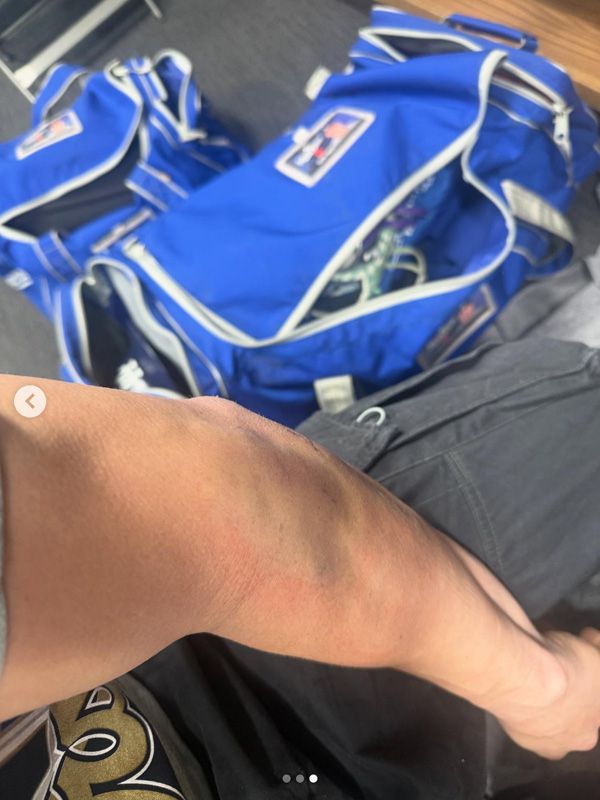 키케 에르난데스는 왼팔꿈치 부상을 참고 포스트시즌을 뛰었다. 사진= 키케 에르난데스 인스타그램.