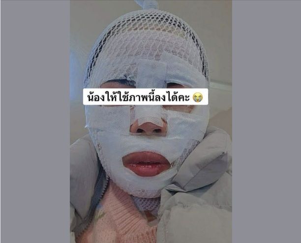 화상 입은 태국인 아내. [페이스북 캡처]