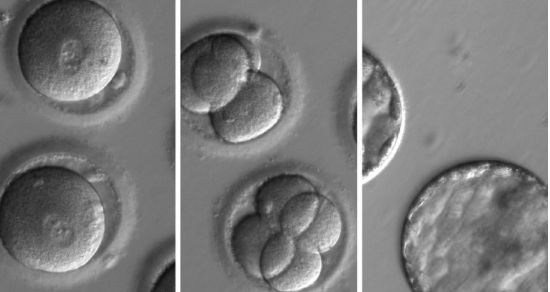 인간 배아. (사진=EPA 연합뉴스)