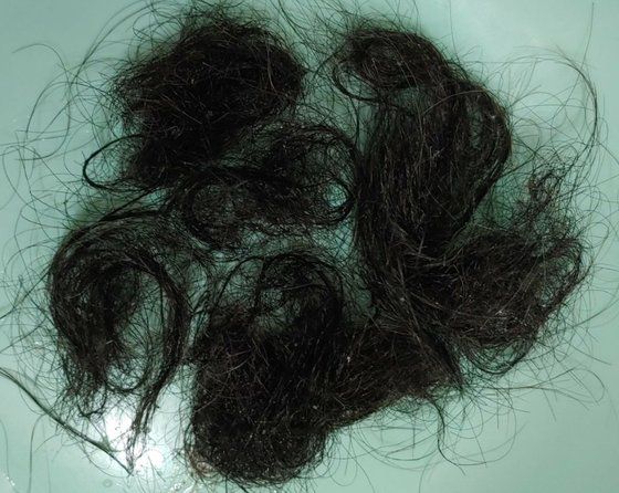 코로나를 겪은 한 신천지 신도가 탈모로 고통받고 있다. 사진은 자신의 머리에서 빠진 머리카락을 모아 촬영한 사진. [사진 신천지 대구교회]