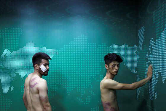 여성 시위를 취재하다 탈레반에게 잡혀가 채찍 등으로 매질을 당한 취재기자와 사진기자. 얼굴과 온 몸에 맞은 자국이 선명하다. 연합뉴스