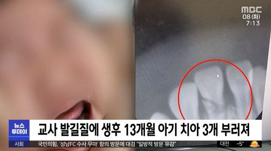 지난 2월 보도된 양산 어린이집 아동학대 사건. [MBC 캡처]