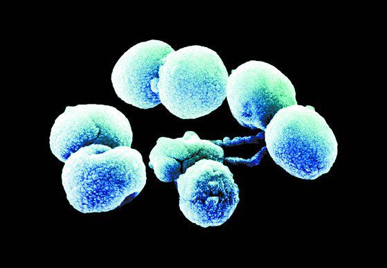 폐렴구균 백신.