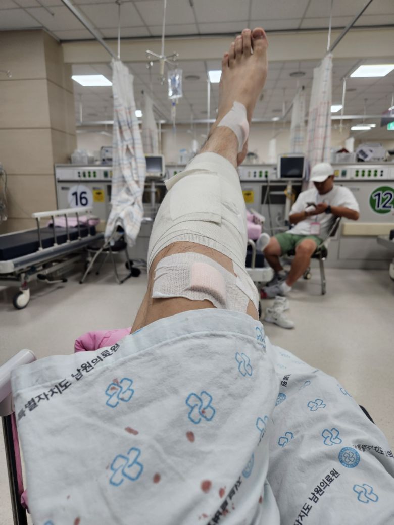 지난 21일 '남원 싱크홀 사고'로 팔다리 등을 다친 박모(46)씨가 사고 당일 남원의료원에서 응급 치료를 받은 모습. 사진 박씨