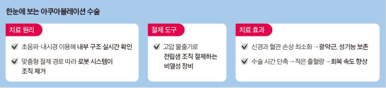 한눈에 보는 아쿠아블레이션 수술