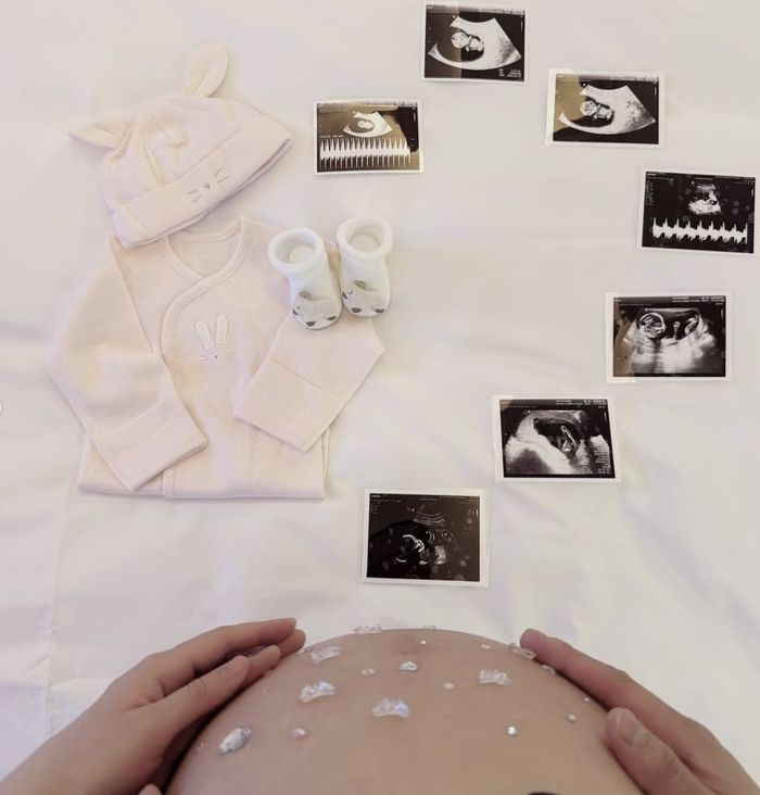 은가은. 사진| SNS