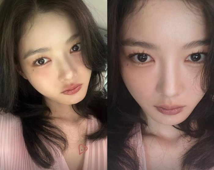 김유정. 사진|SNS