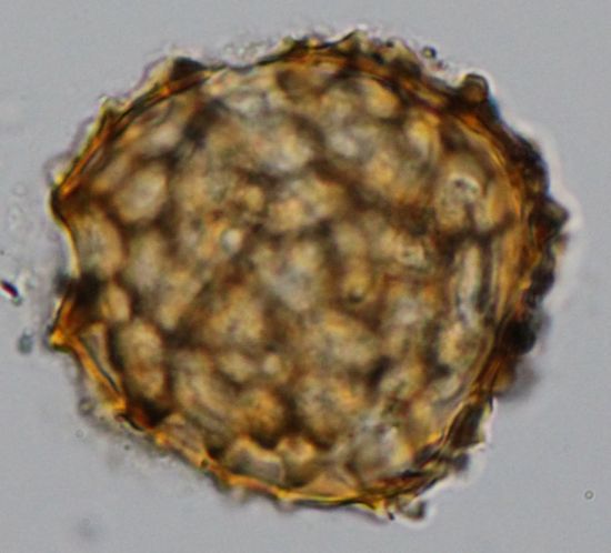 기생충알(편충)