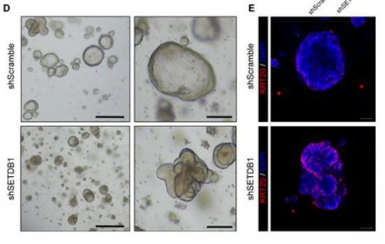 암세포. 자료사진. 기사와 관련이 없음.