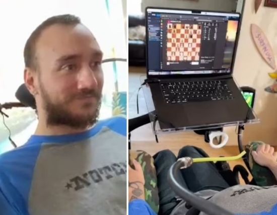 뇌신경과학 스타트업 기업인 뉴럴링크를 이끌고 있는 일론 머스크가 뇌에 컴퓨터 칩을 이식한 환자(사진)가 생각만으로 체스를 두는 모습을 최초로 공개했다. [사진출처=뉴럴링크 X]