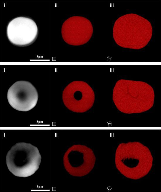 삼투 조건에 따른 혈구 형상 변화를 홀로토모그래피 현미경으로 관찰.