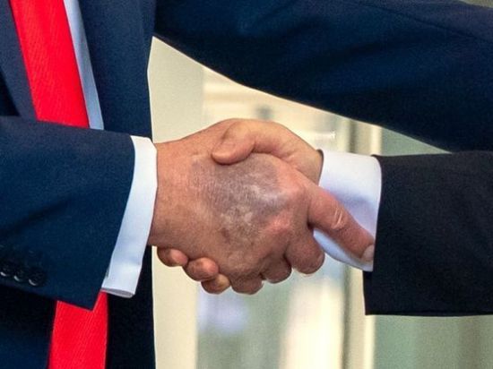 지난달 25일(현지시간) 미국 백악관에서 이재명 대통령과 악수하는 도널드 트럼프 미국 대통령(왼쪽)의 오른손 모습. 손등에 멍으로 보이는 검푸른 자국이 포착됐다. AP연합뉴스