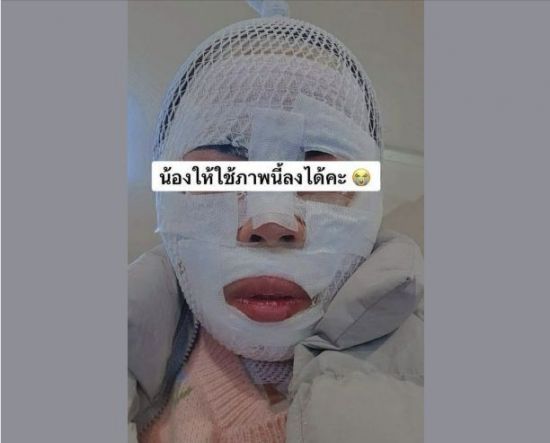 화상 입은 태국인 아내. SNS 갈무리