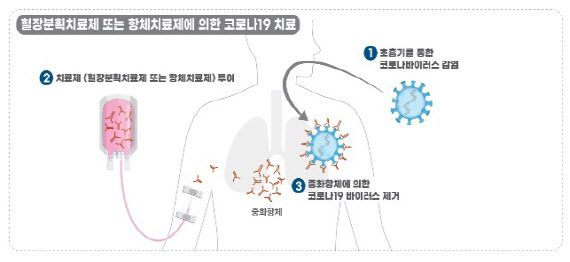 ‘혈장 분획’ 치료제·‘항체’ 치료제 작용 기전. (자료=식품의약품안전처)