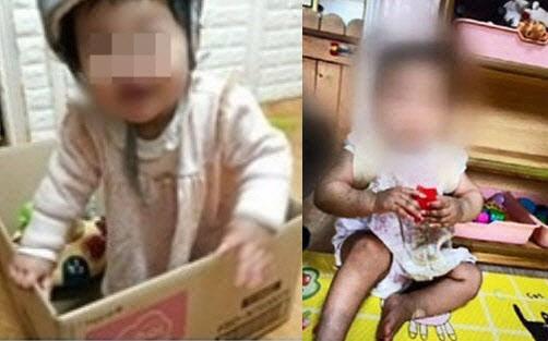 정인이가 입양가정에 보내지기 전(왼쪽)과 후에 극명하게 달라진 모습이 담긴 사진. (사진=온라인 커뮤니티 캡처)
