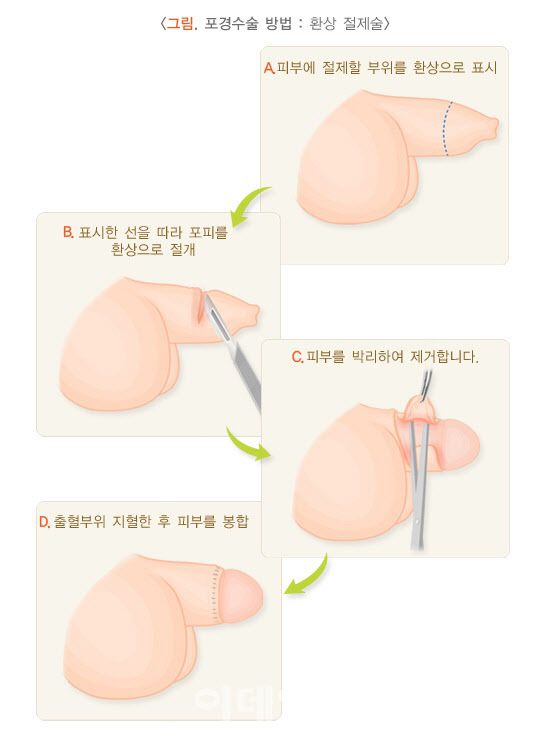 (자료=질병관리청 국가건강정보포털)