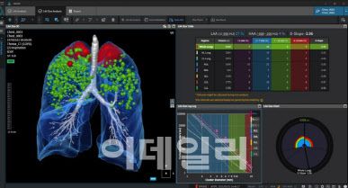 코어라인소프트 폐 질환 진단 제품 (사진=코어라인)