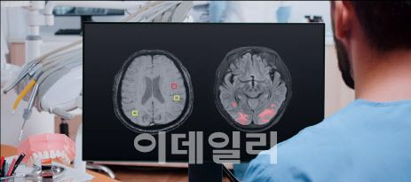 뉴로핏 아쿠아 AI 뇌 영상 분석 제품을 보고 있는 의료진 모습 (사진=뉴로핏)