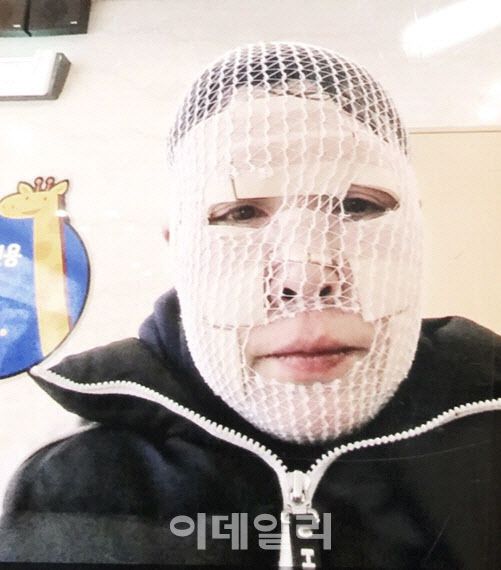 2016년 불길에 뛰어들어 개와 고양이를 구하고 김 소장은 2도 화상을 입어 한 동안 붕대를 감고 지내야 했다.(사진=산수의 천사들)