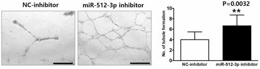 miR-512-3p 억제제 처리 후 모야모야병 환자 세포에서 혈관 형성 능력이 유의미하게 향상됨. NC-inhibitor 처리군과 비교하여 miR-512-3p 억제제 처리군에서 혈관 형성 능력이 향상된 결과가 나타남.