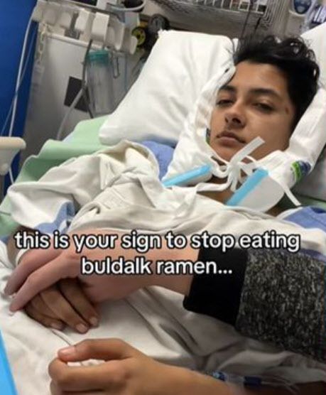 와심이 불닭볶음면 때문에 위궤양에 걸려 입원했다고 주장하며 올린 사진 (사진=와심 틱톡 캡처)