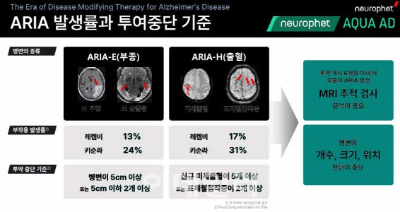 빅파마의 알츠하이머 치료제 부작용 발생률과 투여 중단 기준 (자료=뉴로핏)