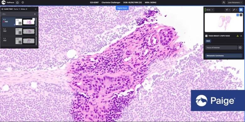 페이지AI 병리 분석 이미지