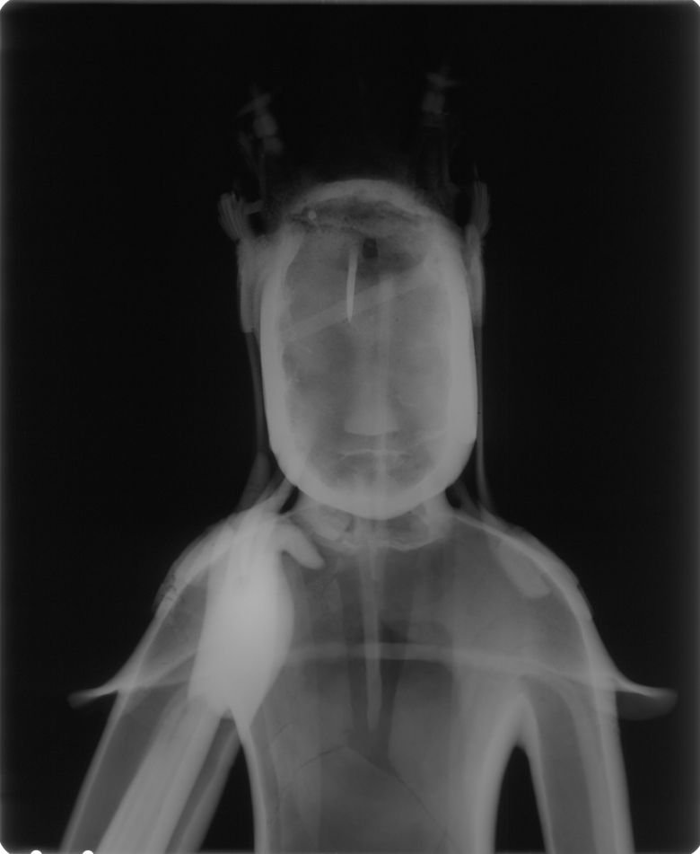 국립중앙박물관특별전 '빛의 과학, 문화재의 비밀을 밝히다'에 나온 국보 78호 금동반가사유상의 감마선 이미지. /국립중앙박물관
