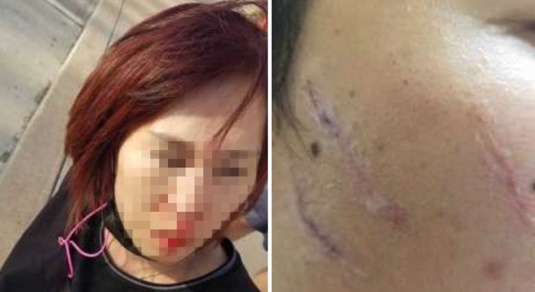 텍사스 휴스턴에서 미용 용품점을 운영하고 있는 정 킴(59)씨가 자신의 업장에서 지난 17일 흑인여성들에게 폭행당해 코뼈가 내려앉는 중상을 당한 것으로 알려졌다./KPRC