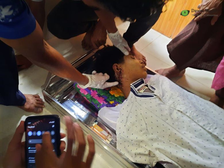 목 뒤에 심각한 총상을 입은 초 민 랏 /다웨이 워치 페이스북