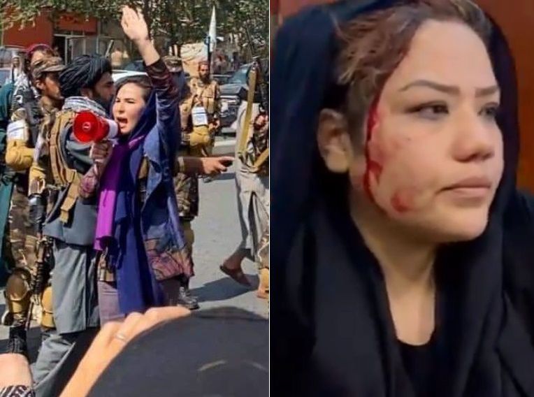 탈레반 세력에 억압받는 여성들이 거리 시위에 나섰다. 오른쪽은 제지당하는 과정에서 상처를 입은 한 여성의 얼굴. /트위터