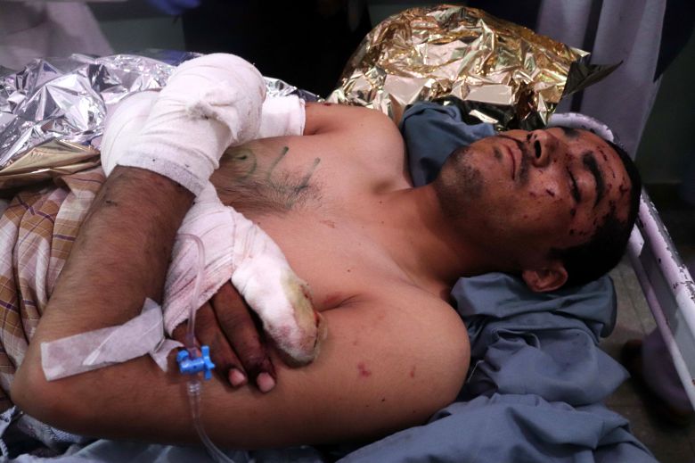 아프가니스탄에서 15일(현지 시각) 발생한 시아파 모스크(이슬람 사원) 자살 폭탄 테러로 부상을 입은 남성./EPA연합뉴스