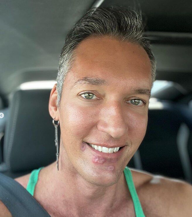 원숭이두창 증상이 나타나고 3주 이상이 지난 후 실버스틸의 증상이 호전됐다./실버 스틸 인스타그램