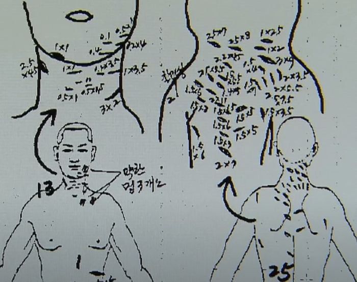 피해자인 박한상 부모의 부검 소견서 중 일부. /MBC 유튜브 영상