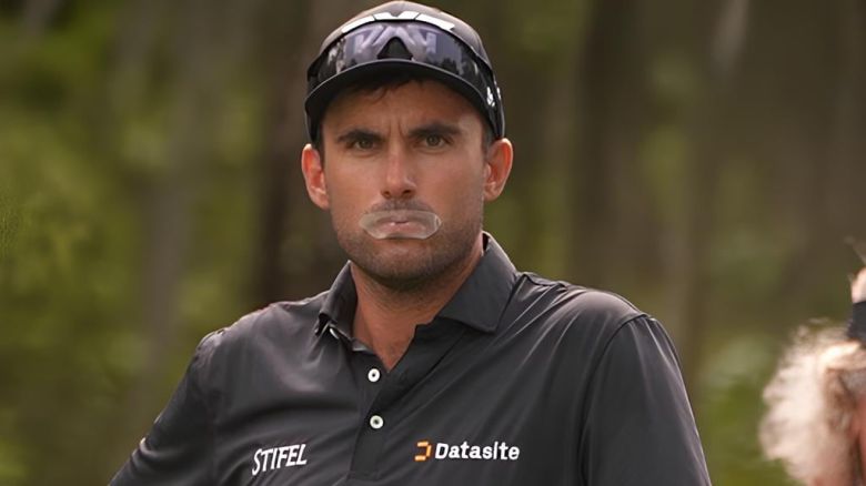 입술에 투명 테이프를 붙이고 경기에 나선 미국 골퍼 라이언 매코믹. /PGA 투어