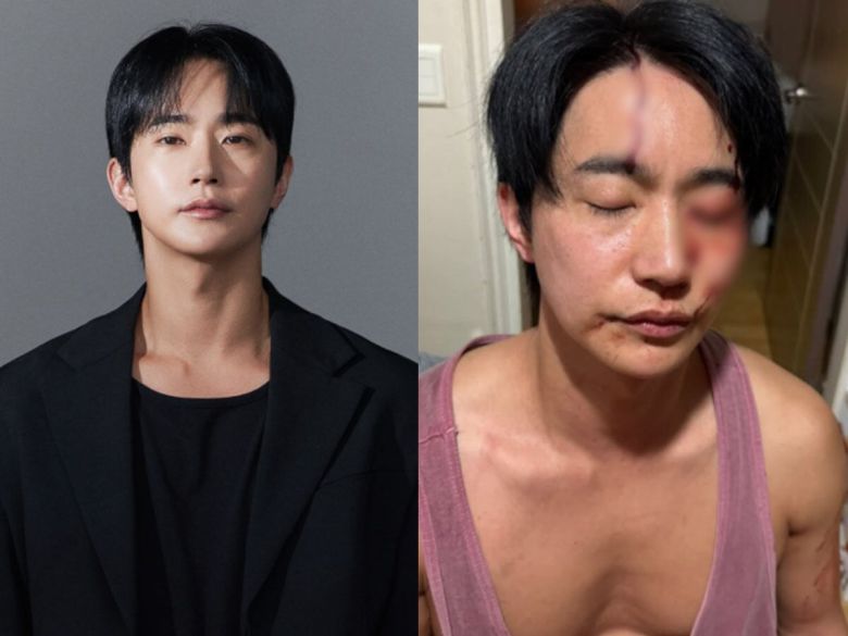 뮤지컬 배우 전호준(왼쪽)은 25일 자신의 인스타그램에 전날 일어난 연인과의 폭행 사건 관련 자신이 피 흘리고 있는 모습의 사진을 공개했다. /전호준 인스타그램