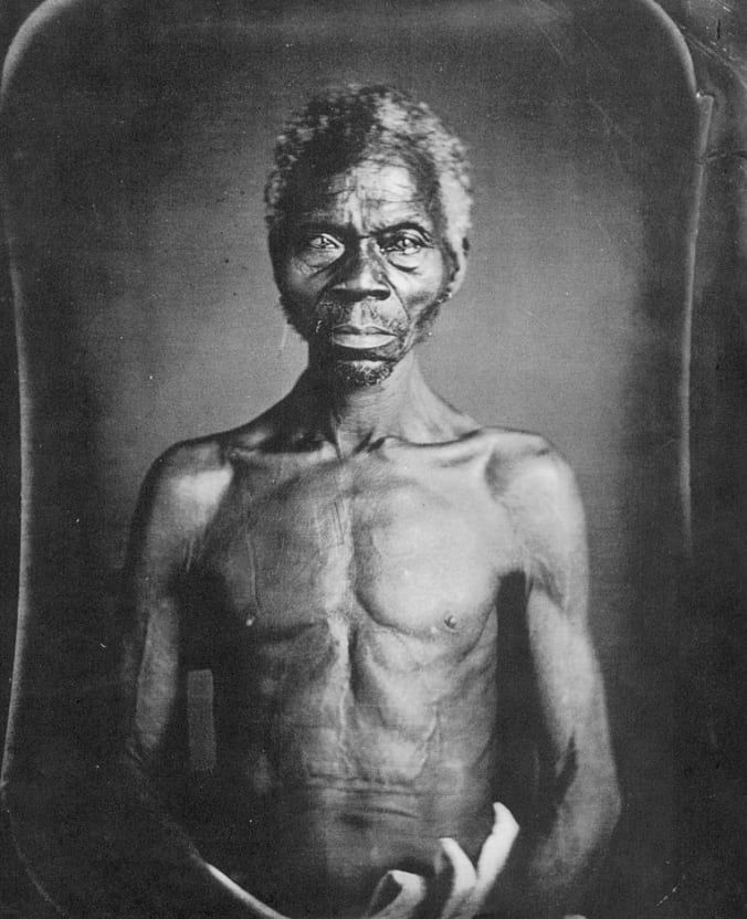 뉴욕타임스에 따르면 '파파 렌티'의 사진은 미국에서 가장 오래된 노예 사진이다./X