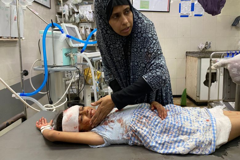 가자지구 남부의 한 병원에서 이스라엘의 공습으로 부상당한 소녀가 치료받고 있다./AFP 연합뉴스