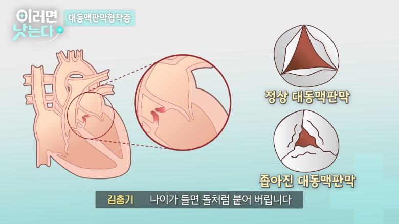 /조선일보 의학·건강 유튜브 '이러면 낫는다'